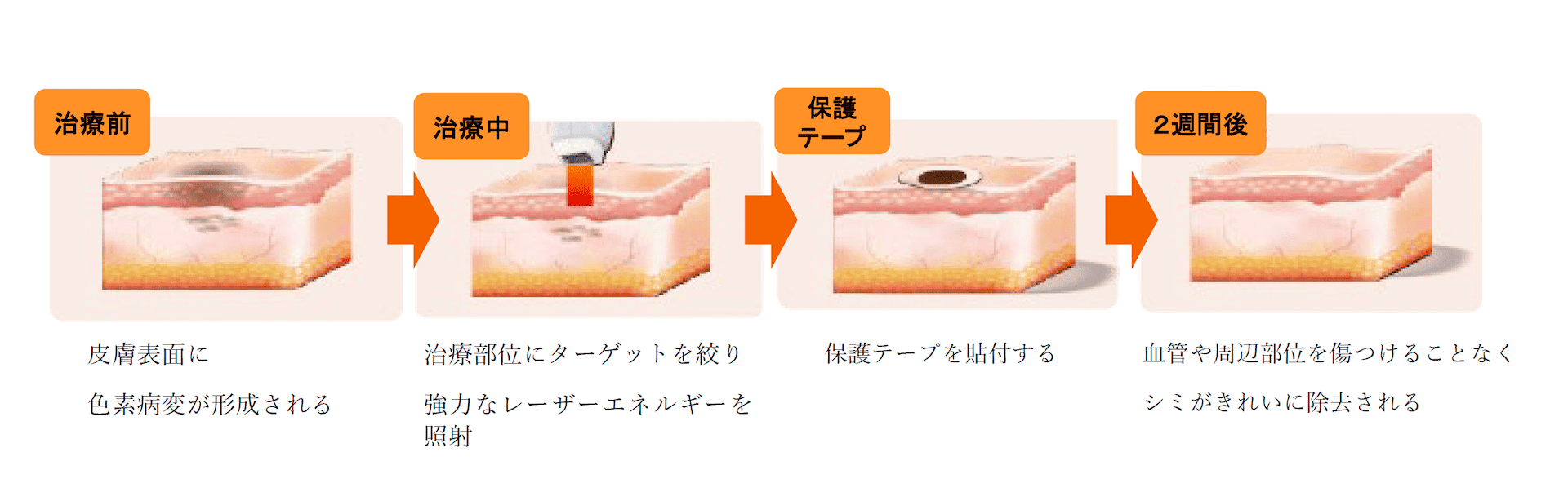 画像に alt 属性が指定されていません。ファイル名: reepot-flow.png